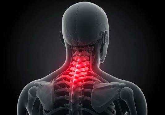Cervical Spondylosis in Jaipur: Symptoms, Causes & Physiotherapy for Neck Pain Relief